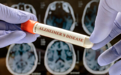 Groundbreaking Study Shows NAD⁺ Restores Memory in Alzheimer’s Models